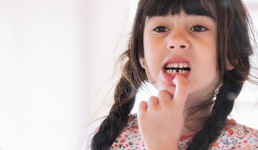 Bekommen backenzähne wann kinder Zahnwechsel bei